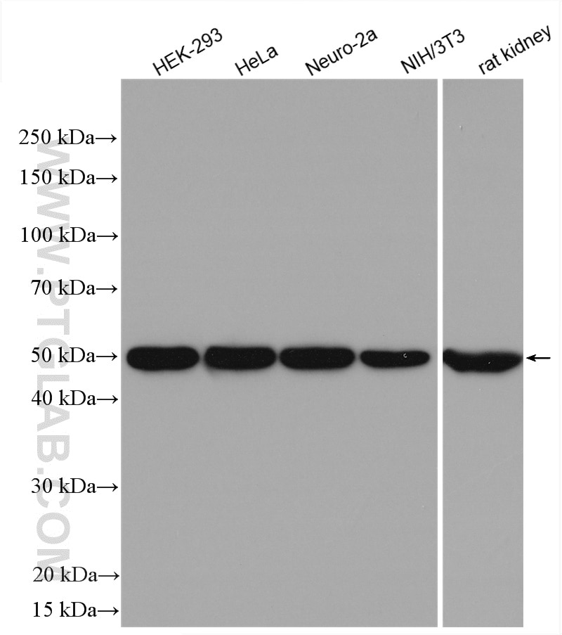 Western Blot (WB) analysis of various lysates using NADK Polyclonal antibody (29290-1-AP)