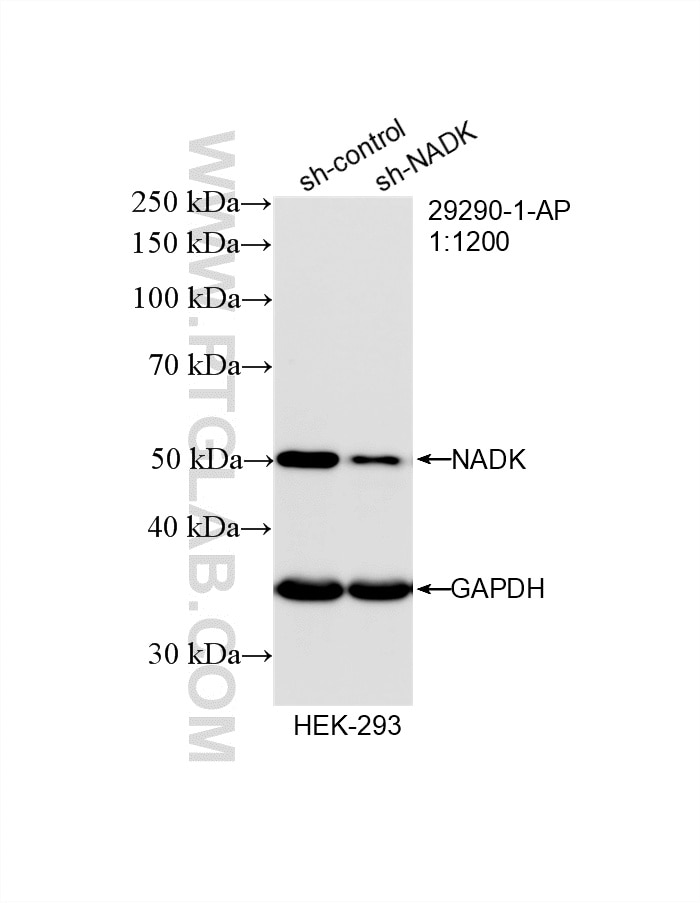 Western Blot (WB) analysis of HEK-293 cells using NADK Polyclonal antibody (29290-1-AP)