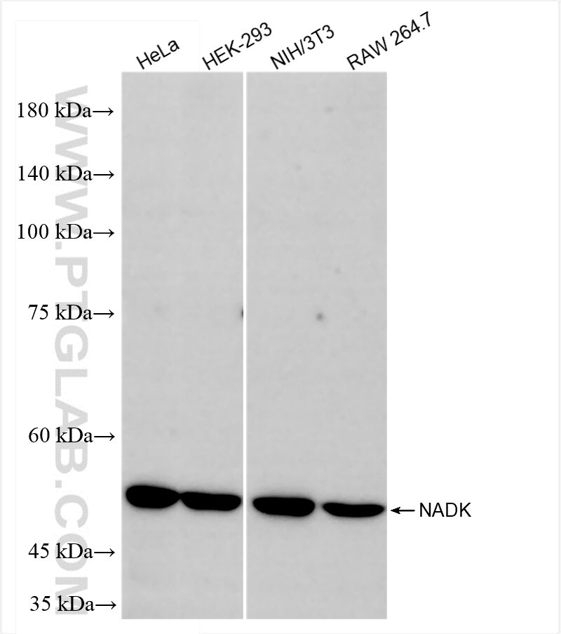 Western Blot (WB) analysis of various lysates using NADK Recombinant antibody (84996-1-RR)