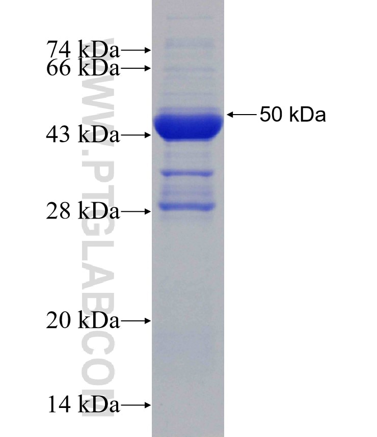 NADK fusion protein Ag30982 SDS-PAGE