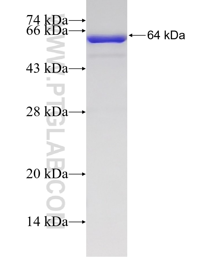 NADK fusion protein Ag7906 SDS-PAGE