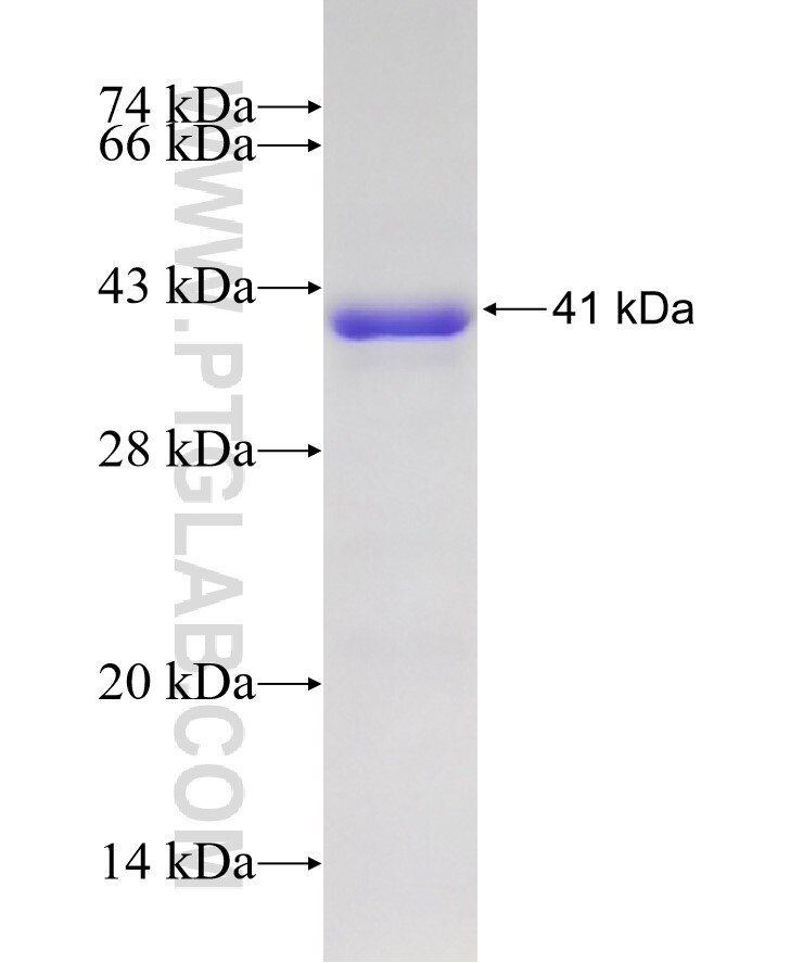 NADK fusion protein Ag8117 SDS-PAGE