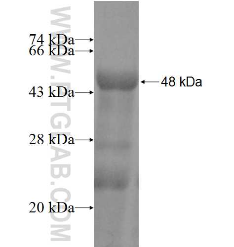 NADSYN1 fusion protein Ag6668 SDS-PAGE