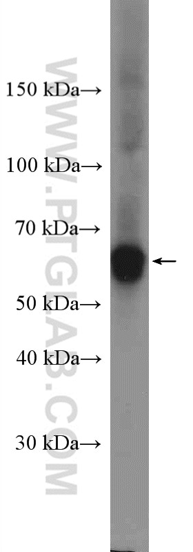 Western Blot (WB) analysis of mouse brain tissue using APPBP1 Polyclonal antibody (14863-1-AP)