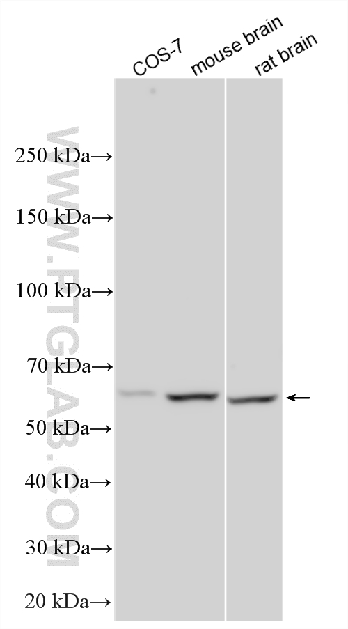 WB analysis using 14863-1-AP Western Blot (WB) analysis of various lysates using APPBP1 Polyclonal antibody (14863-1-AP)