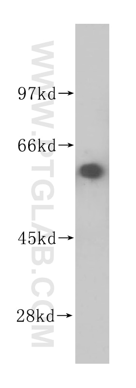 Western Blot (WB) analysis of human kidney tissue using APPBP1 Polyclonal antibody (14863-1-AP)