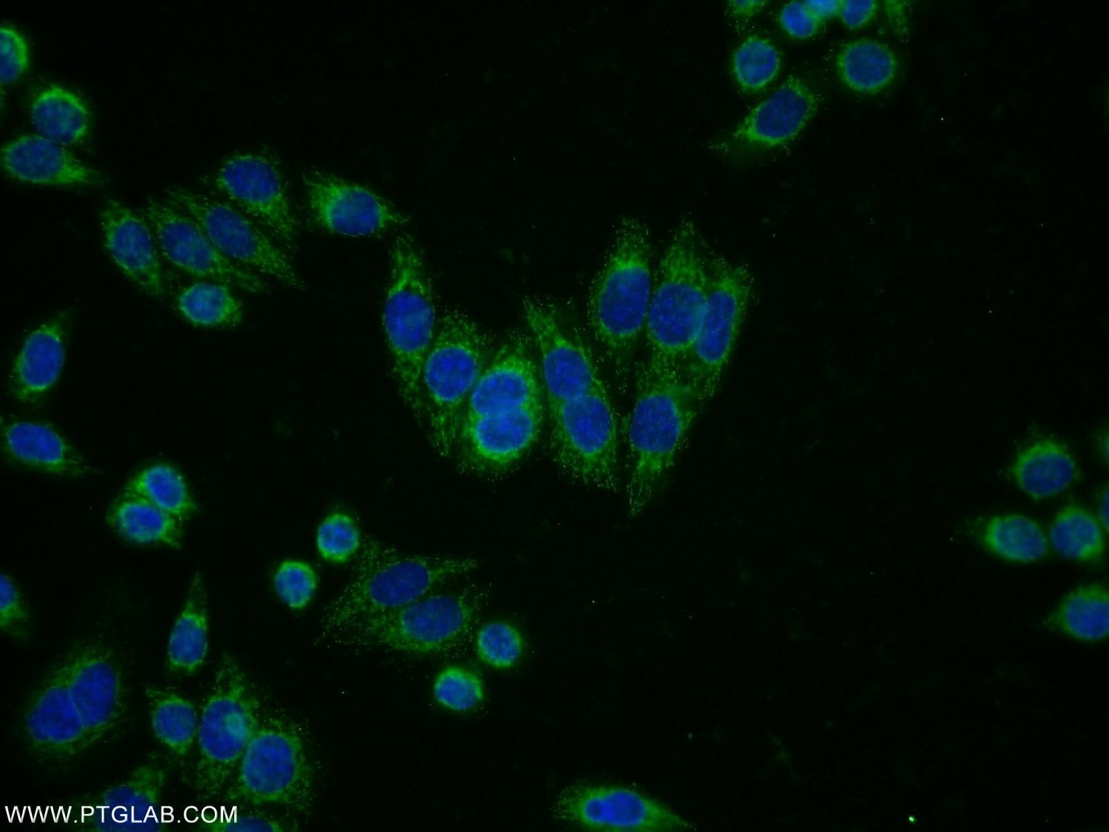 Immunofluorescence (IF) / fluorescent staining of HeLa cells using NAGA Polyclonal antibody (15096-1-AP)
