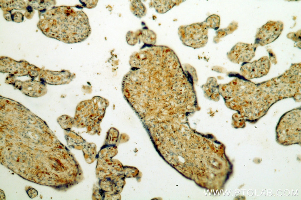 Immunohistochemistry (IHC) staining of human placenta tissue using NAGA Polyclonal antibody (15096-1-AP)