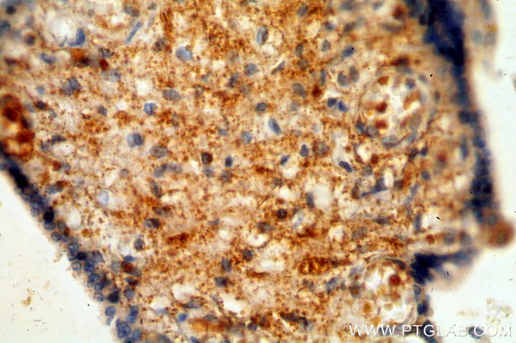 IHC staining of human placenta using 15096-1-AP