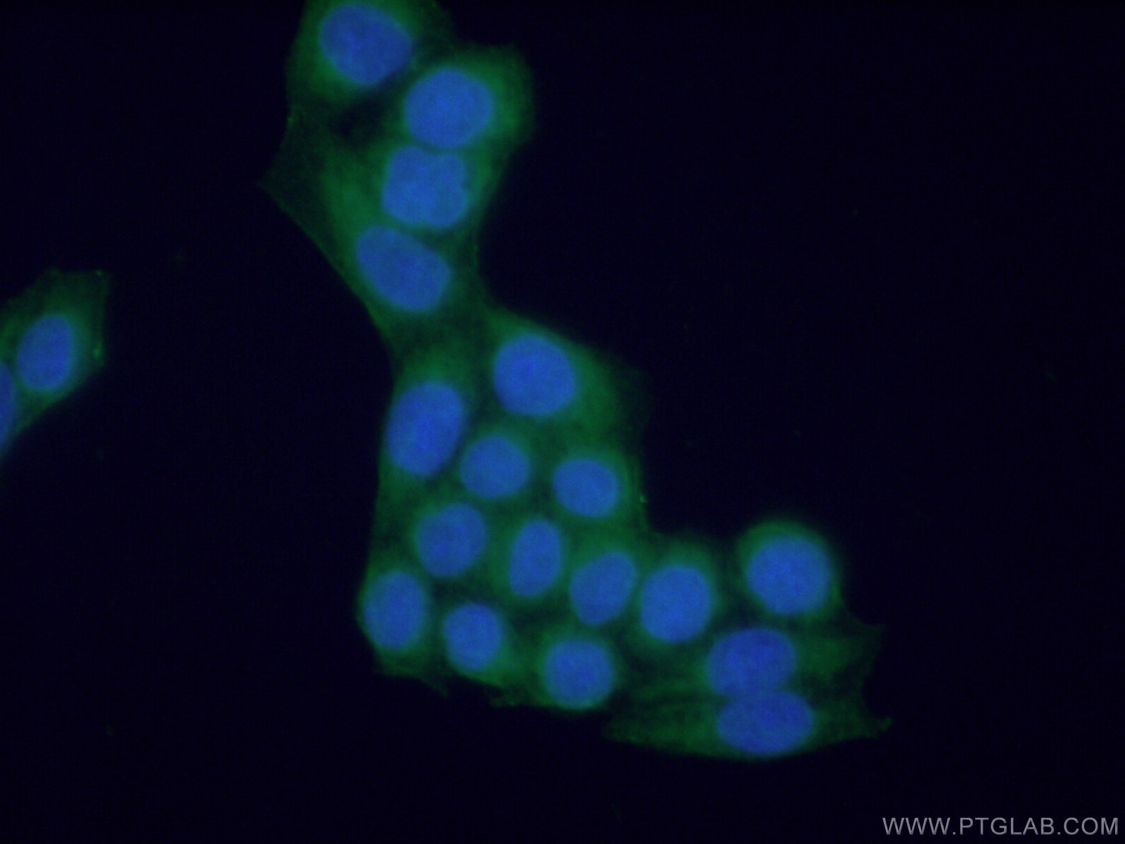 Immunofluorescence (IF) / fluorescent staining of HeLa cells using NAGK Polyclonal antibody (15051-1-AP)