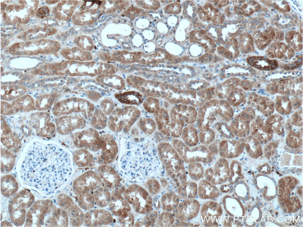 Immunohistochemistry (IHC) staining of human kidney tissue using NAGK Polyclonal antibody (15051-1-AP)