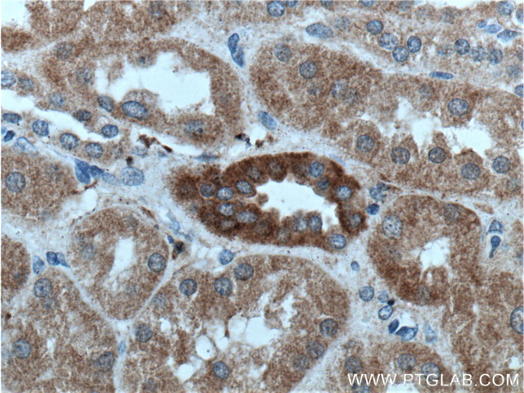 Immunohistochemistry (IHC) staining of human kidney tissue using NAGK Polyclonal antibody (15051-1-AP)