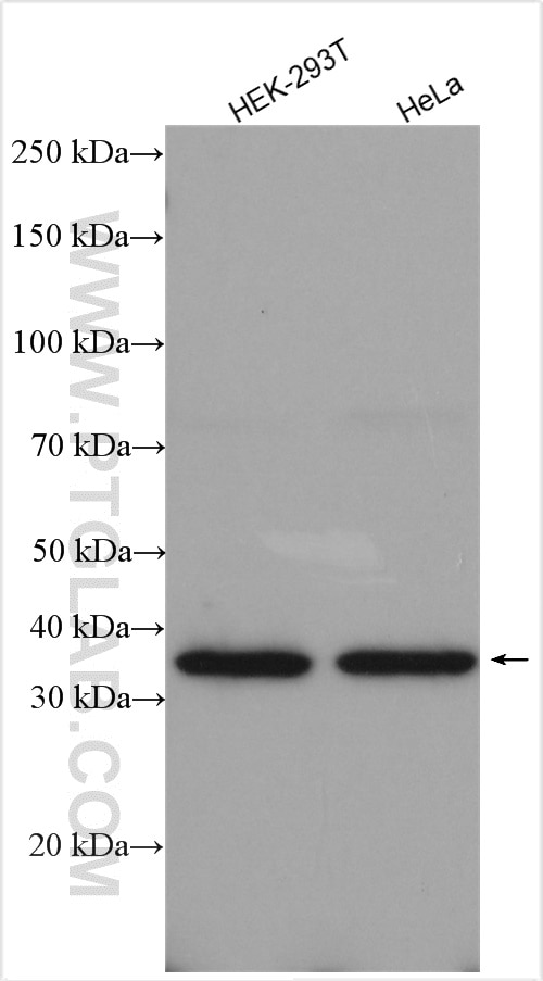 Western Blot (WB) analysis of various lysates using NAGK Polyclonal antibody (15051-1-AP)