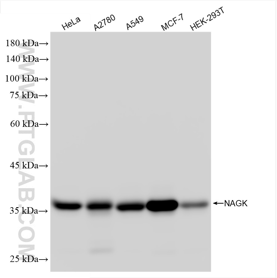 Various lysates were subjected to SDS PAGE followed by western blot with 86506-1-RR (NAGK antibody) at dilution of 1:5000 incubated at room temperature for 1.5 hours. Western Blot (WB) analysis of various lysates using NAGK Recombinant antibody (86506-1-RR)