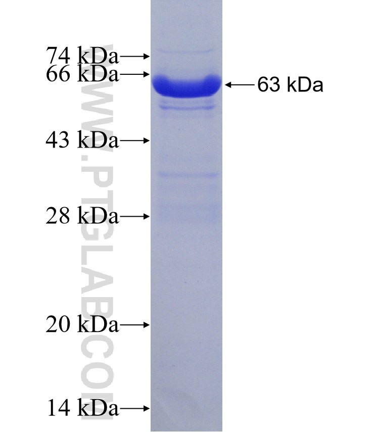 NAGK fusion protein Ag7034 SDS-PAGE