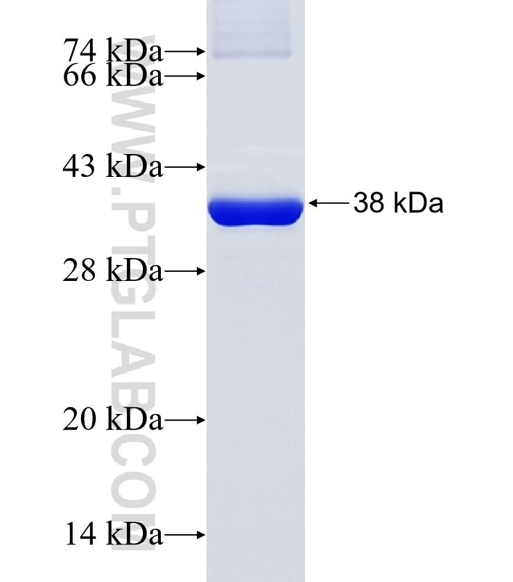 NAGK fusion protein Ag7042 SDS-PAGE