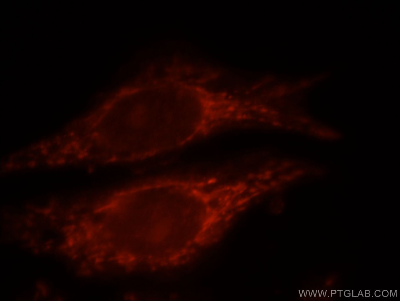 Immunofluorescence (IF) / fluorescent staining of HeLa cells using NAGS Polyclonal antibody (21566-1-AP)