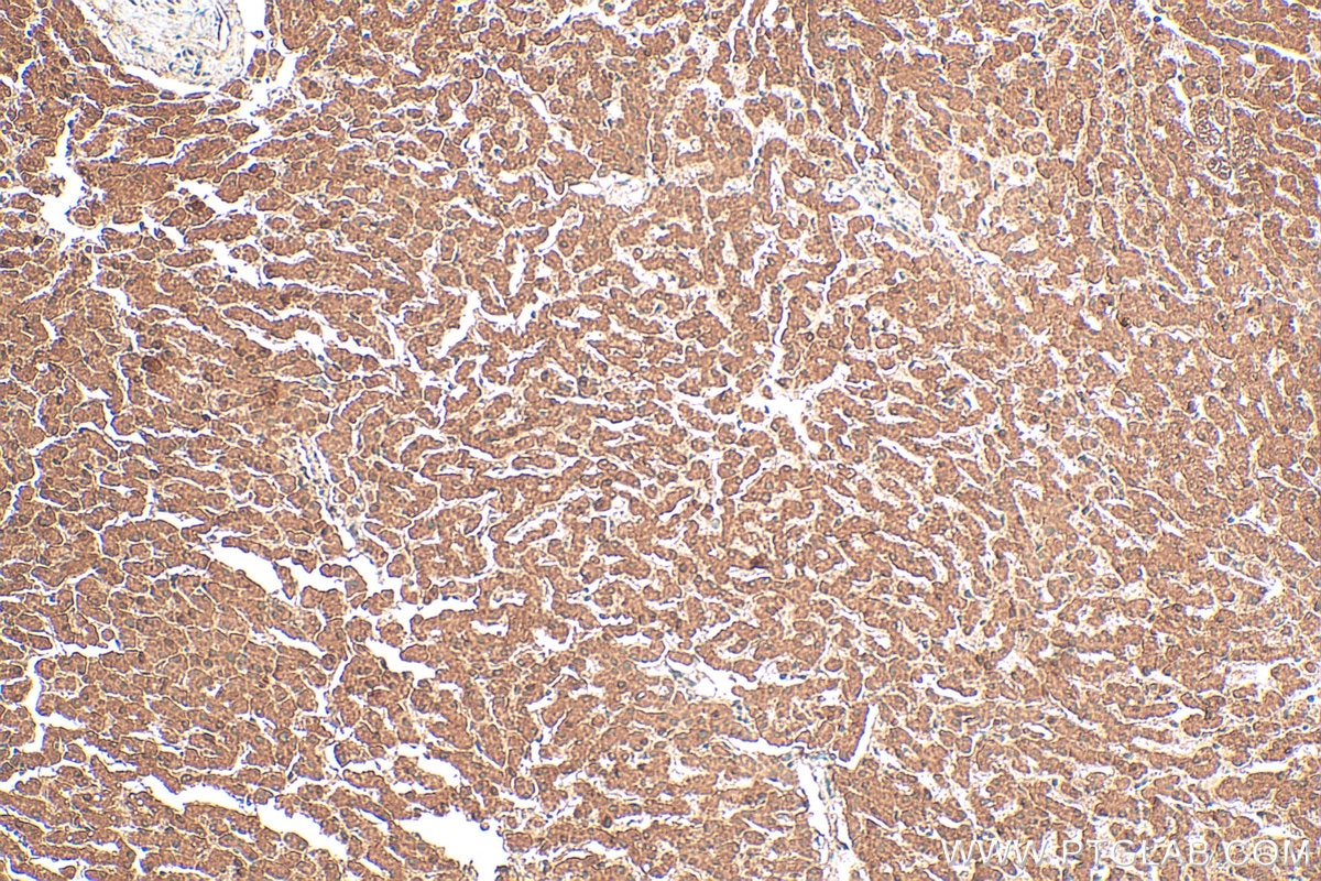 Immunohistochemistry (IHC) staining of human liver tissue using NAGS Polyclonal antibody (21566-1-AP)
