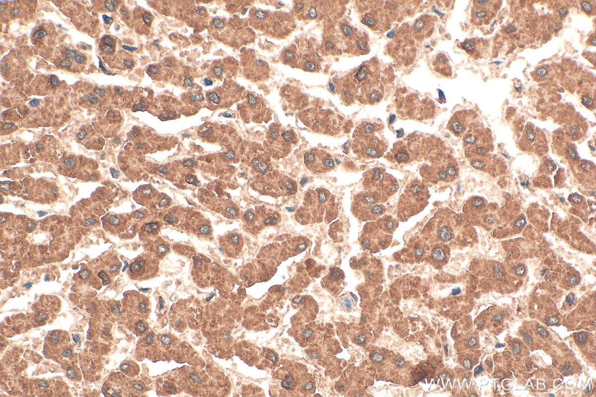 Immunohistochemistry (IHC) staining of human liver tissue using NAGS Polyclonal antibody (21566-1-AP)