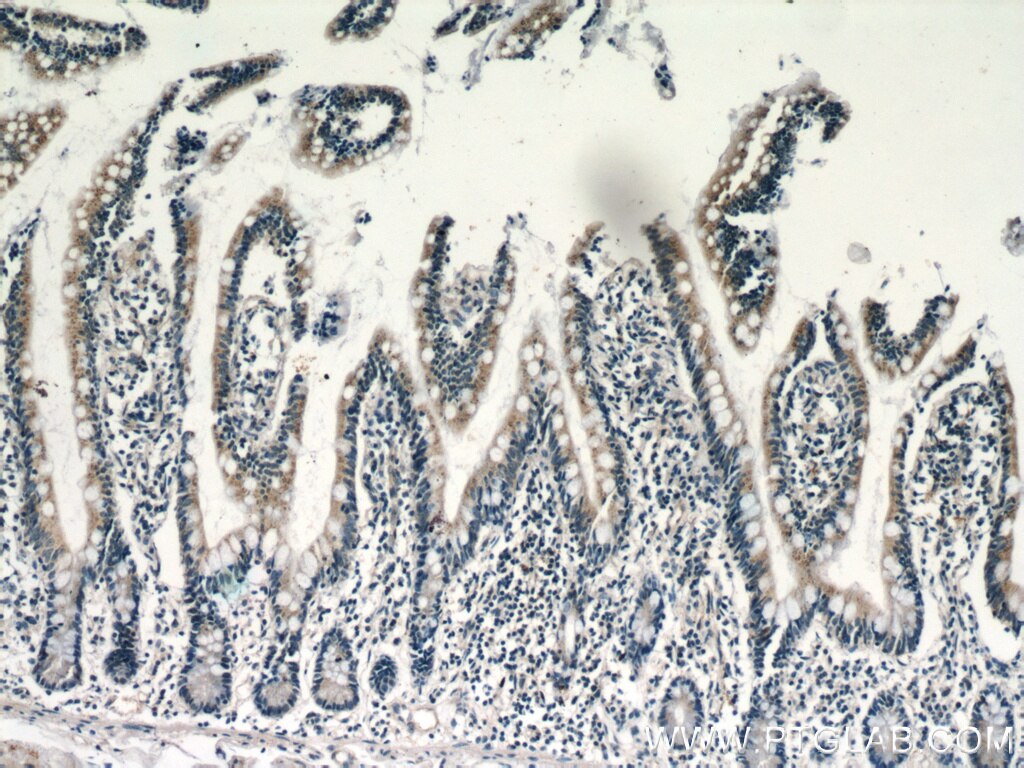 IHC staining of human small intestine using 21566-1-AP