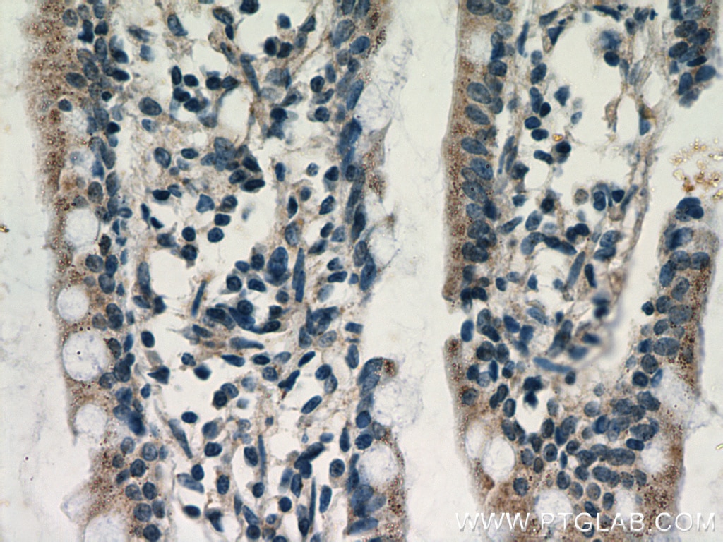 Immunohistochemistry (IHC) staining of human small intestine tissue using NAGS Polyclonal antibody (21566-1-AP)