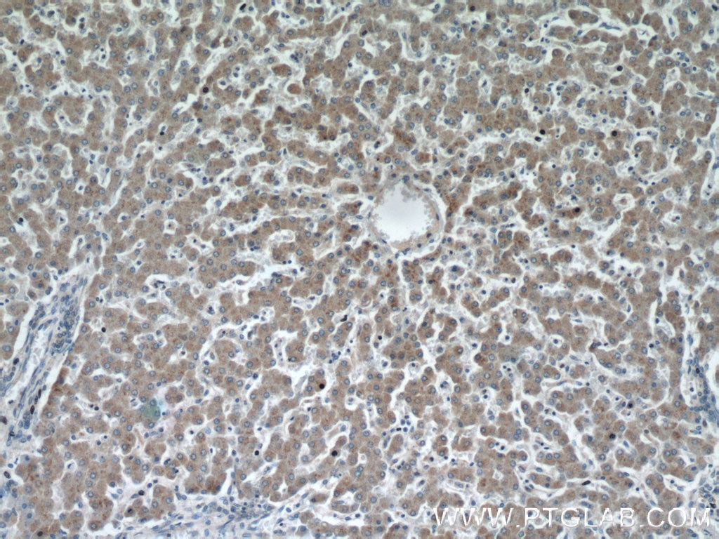 IHC staining of human liver using 21566-1-AP