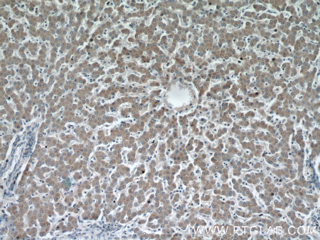 Immunohistochemistry (IHC) staining of human liver tissue using NAGS Polyclonal antibody (21566-1-AP)