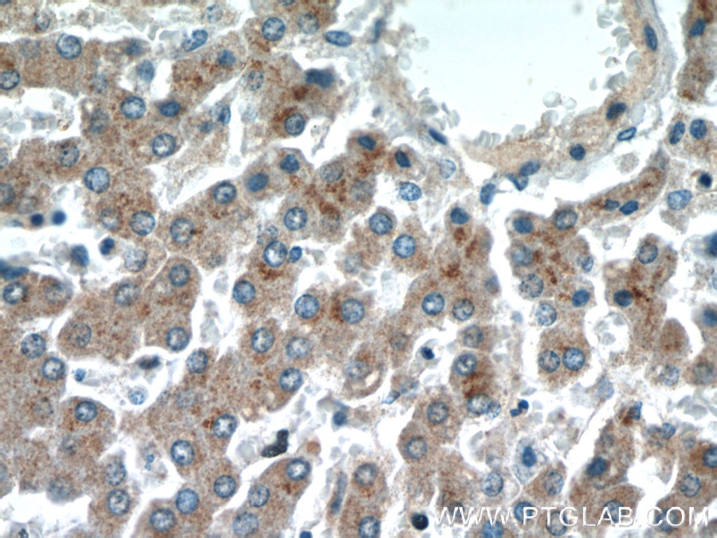 Immunohistochemistry (IHC) staining of human liver tissue using NAGS Polyclonal antibody (21566-1-AP)