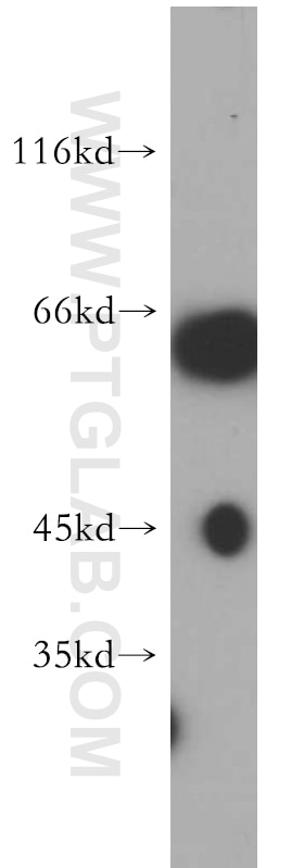 Western Blot (WB) analysis of Jurkat cells using NAGS Polyclonal antibody (21566-1-AP)