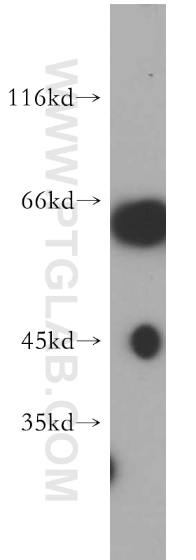 WB analysis of Jurkat using 21566-1-AP