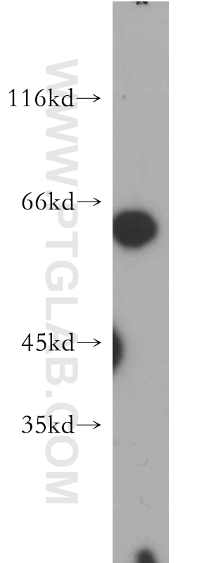 Western Blot (WB) analysis of HepG2 cells using NAGS Polyclonal antibody (21566-1-AP)