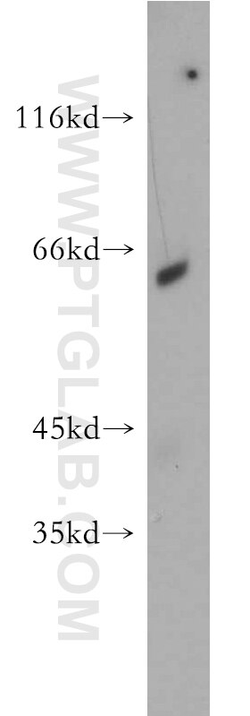 Western Blot (WB) analysis of L02 cells using NAGS Polyclonal antibody (21566-1-AP)