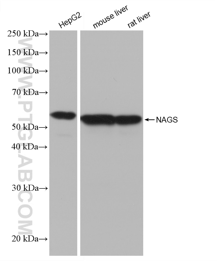 Western Blot (WB) analysis of various lysates using NAGS Recombinant antibody (82963-1-RR)