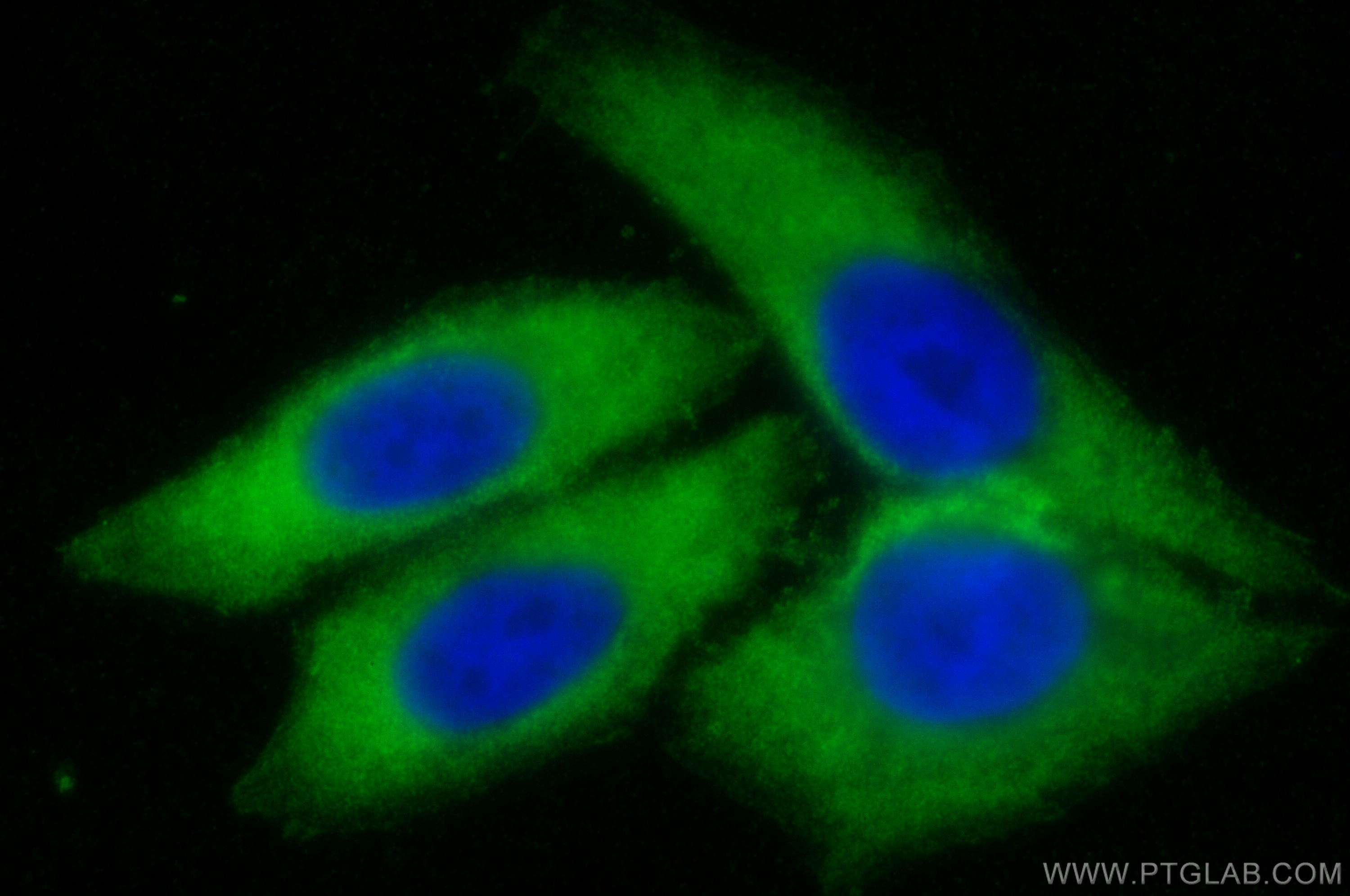 Immunofluorescence (IF) / fluorescent staining of HepG2 cells using NLRP3 Polyclonal antibody (19771-1-AP)