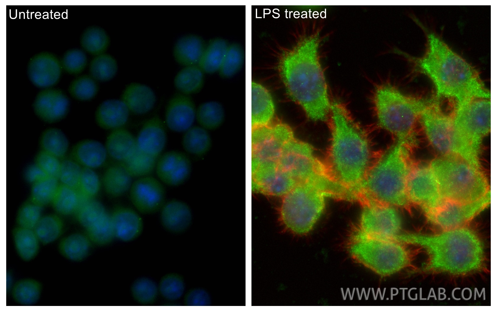 IF Staining of RAW 264.7 using 19771-1-AP Immunofluorescence (IF) / fluorescent staining of RAW 264.7 cells using NLRP3 Polyclonal antibody (19771-1-AP)
