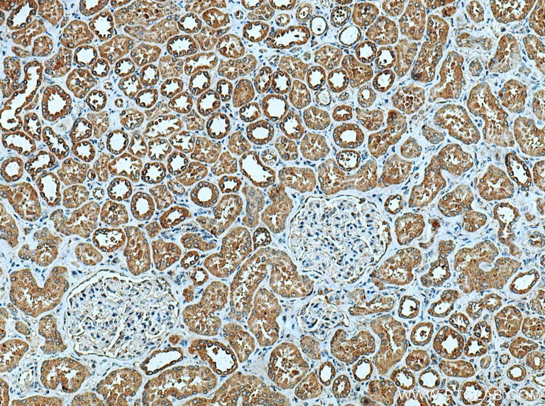 Immunohistochemistry (IHC) staining of human kidney tissue using NLRP3 Polyclonal antibody (19771-1-AP)