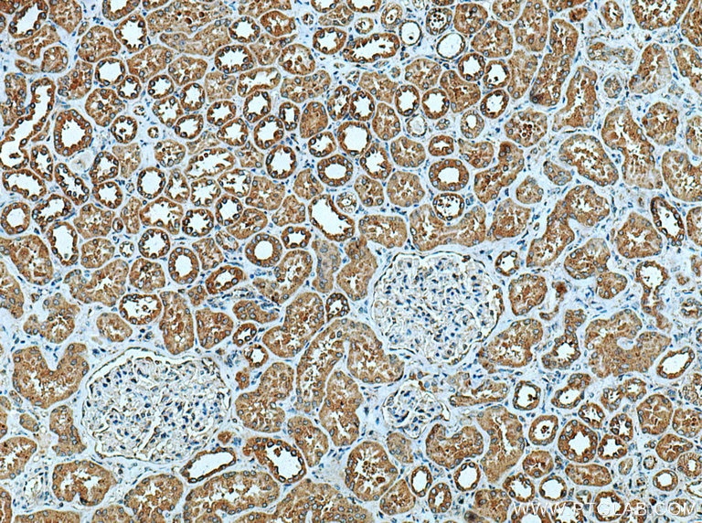 IHC staining of human kidney using 19771-1-AP