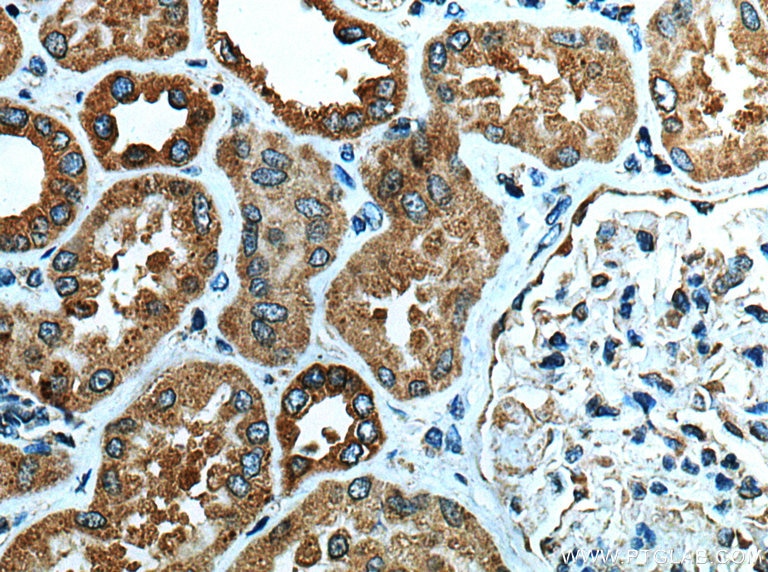 Immunohistochemistry (IHC) staining of human kidney tissue using NLRP3 Polyclonal antibody (19771-1-AP)