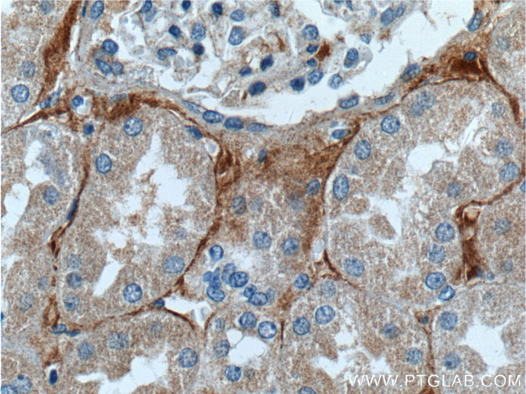 NLRP3 Polyclonal antibody