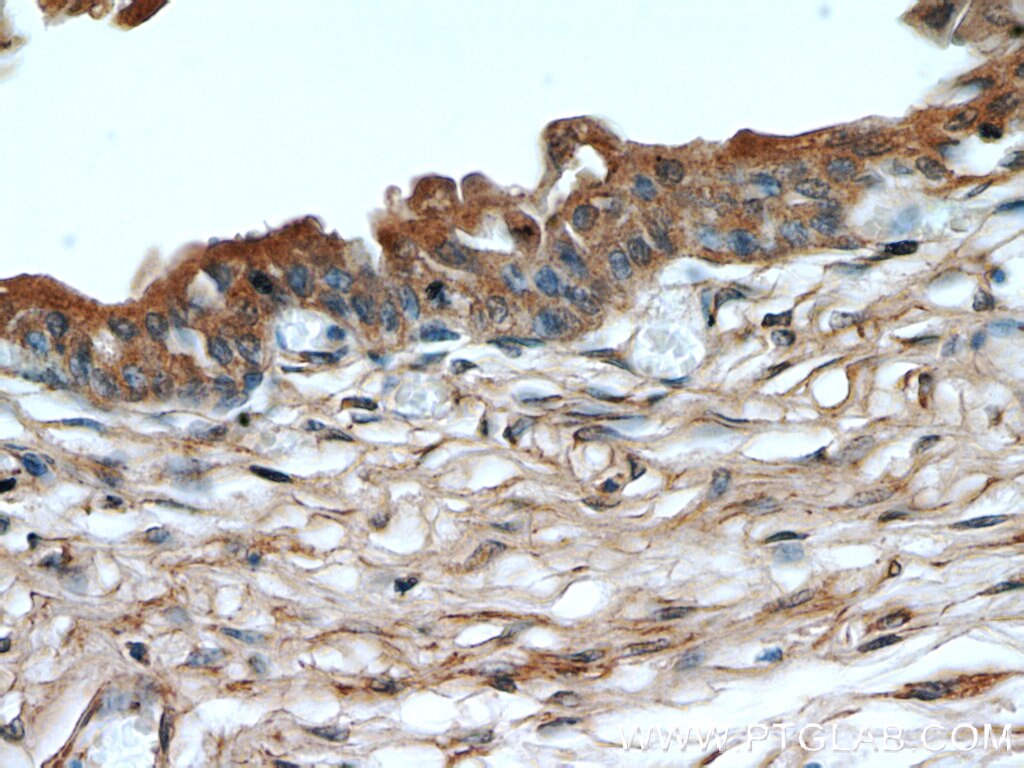 NLRP3 Polyclonal antibody