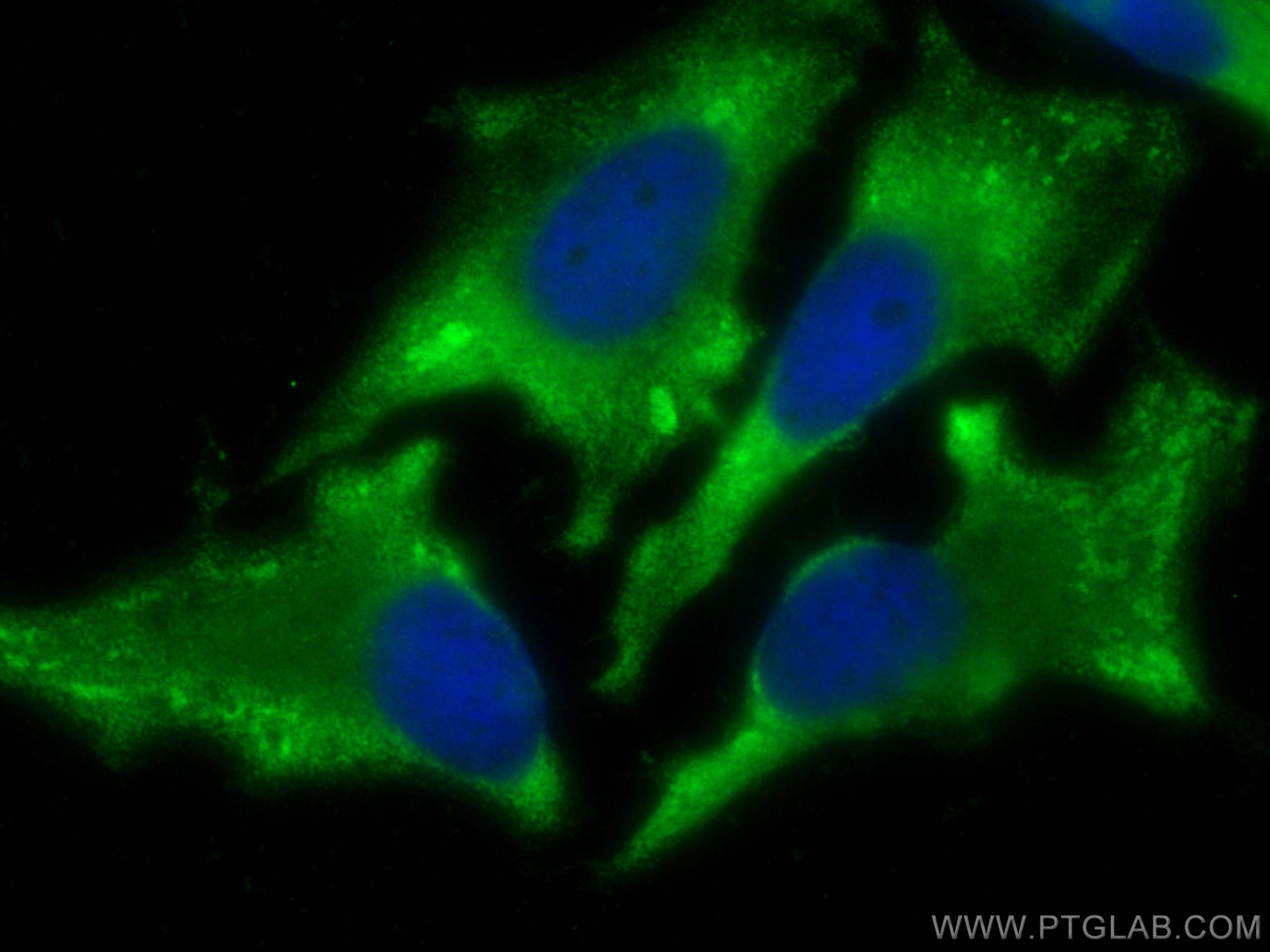 Immunofluorescence (IF) / fluorescent staining of HeLa cells using NAMPT/PBEF Polyclonal antibody (11776-1-AP)