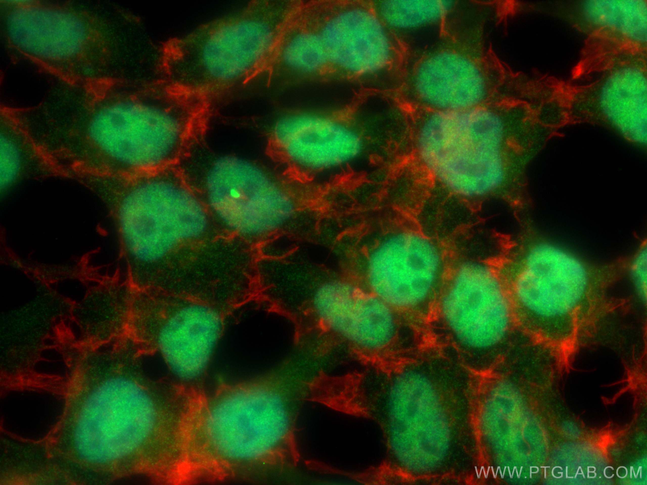 Immunofluorescence (IF) / fluorescent staining of HEK-293 cells using NAMPT/PBEF Polyclonal antibody (11776-1-AP)