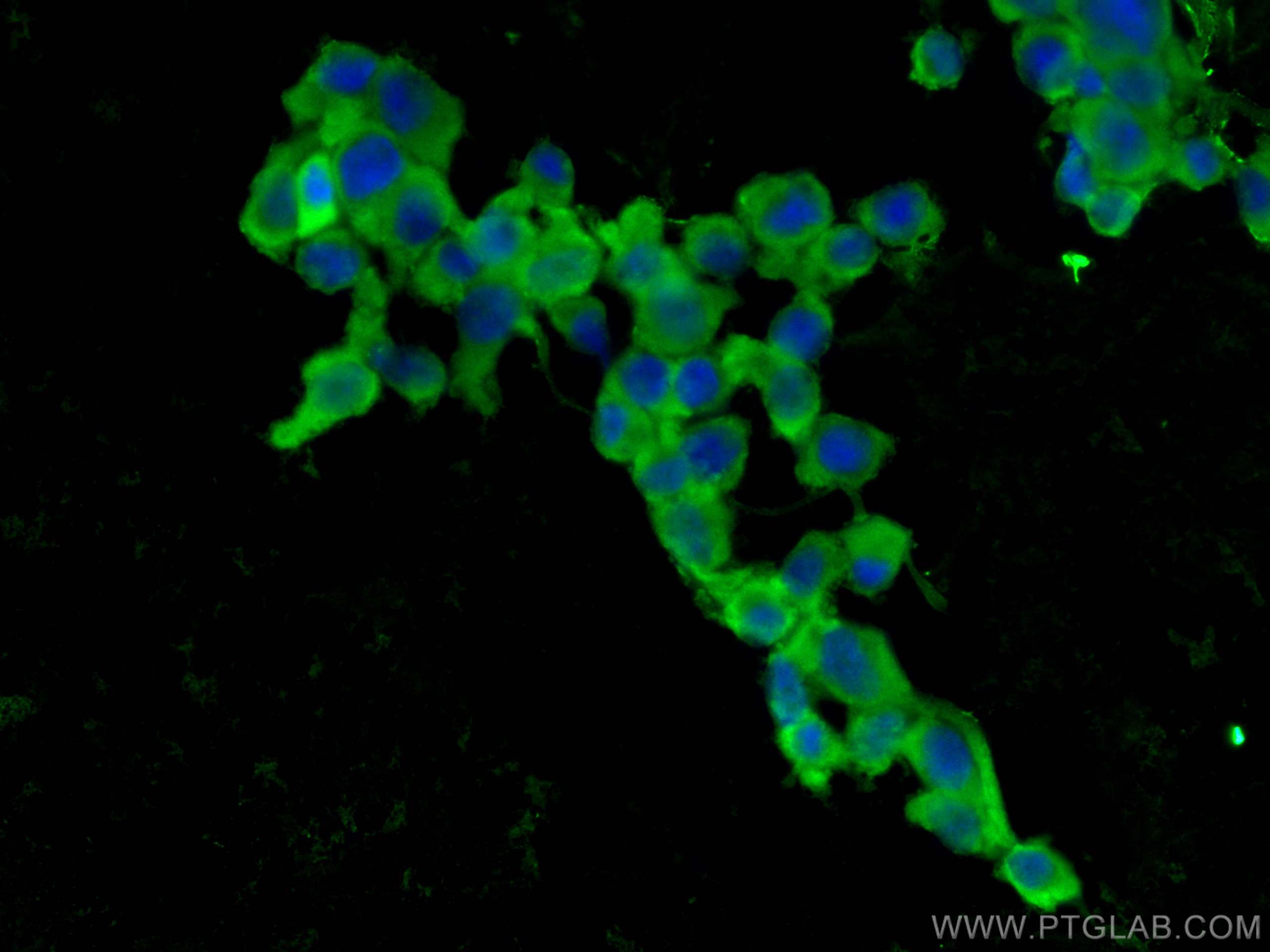 IF Staining of U-87 MG using 11776-1-AP