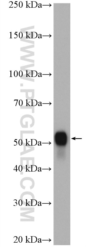 Western Blot (WB) analysis of RAW 264.7 cells using NAMPT/PBEF Polyclonal antibody (11776-1-AP)