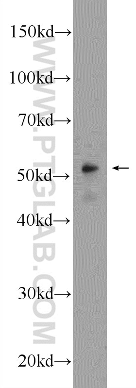 Western Blot (WB) analysis of zebrafish tissue using NAMPT/PBEF Polyclonal antibody (11776-1-AP)