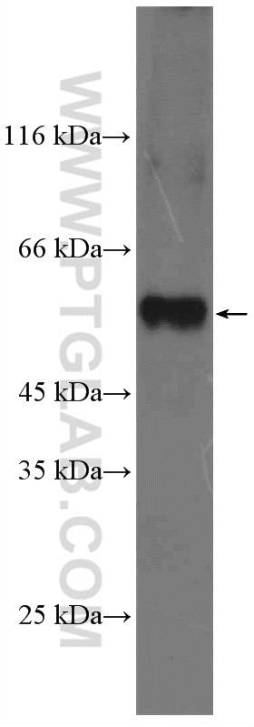 WB analysis of mouse skeletal muscle using 11776-1-AP