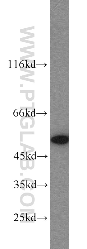 Western Blot (WB) analysis of mouse heart tissue using NAMPT/PBEF Polyclonal antibody (11776-1-AP)