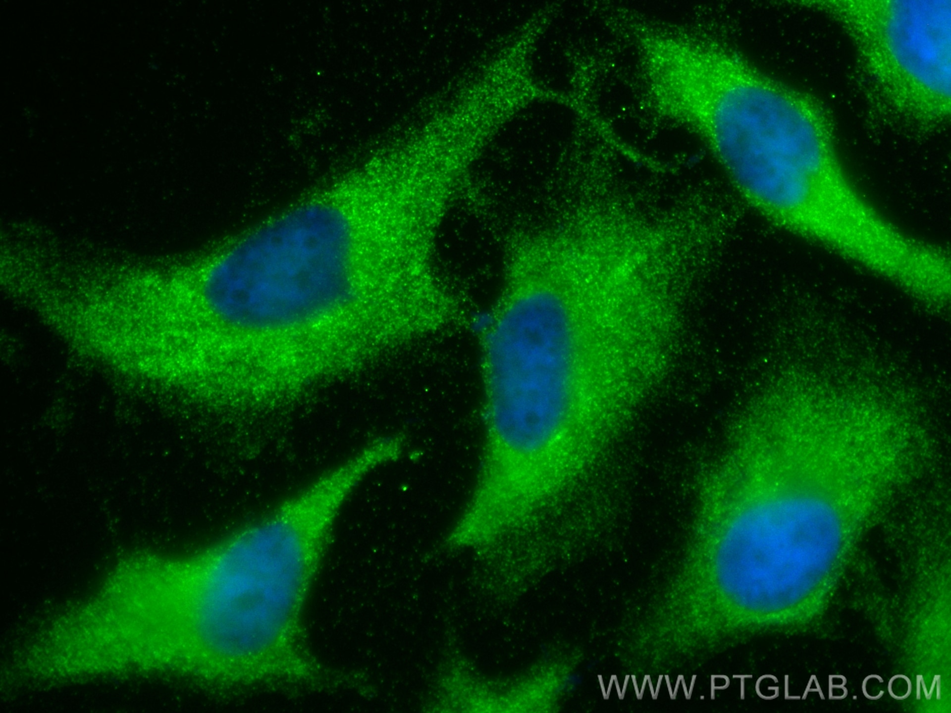 Immunofluorescence (IF) / fluorescent staining of HeLa cells using NAMPT/PBEF Monoclonal antibody (66385-1-Ig)