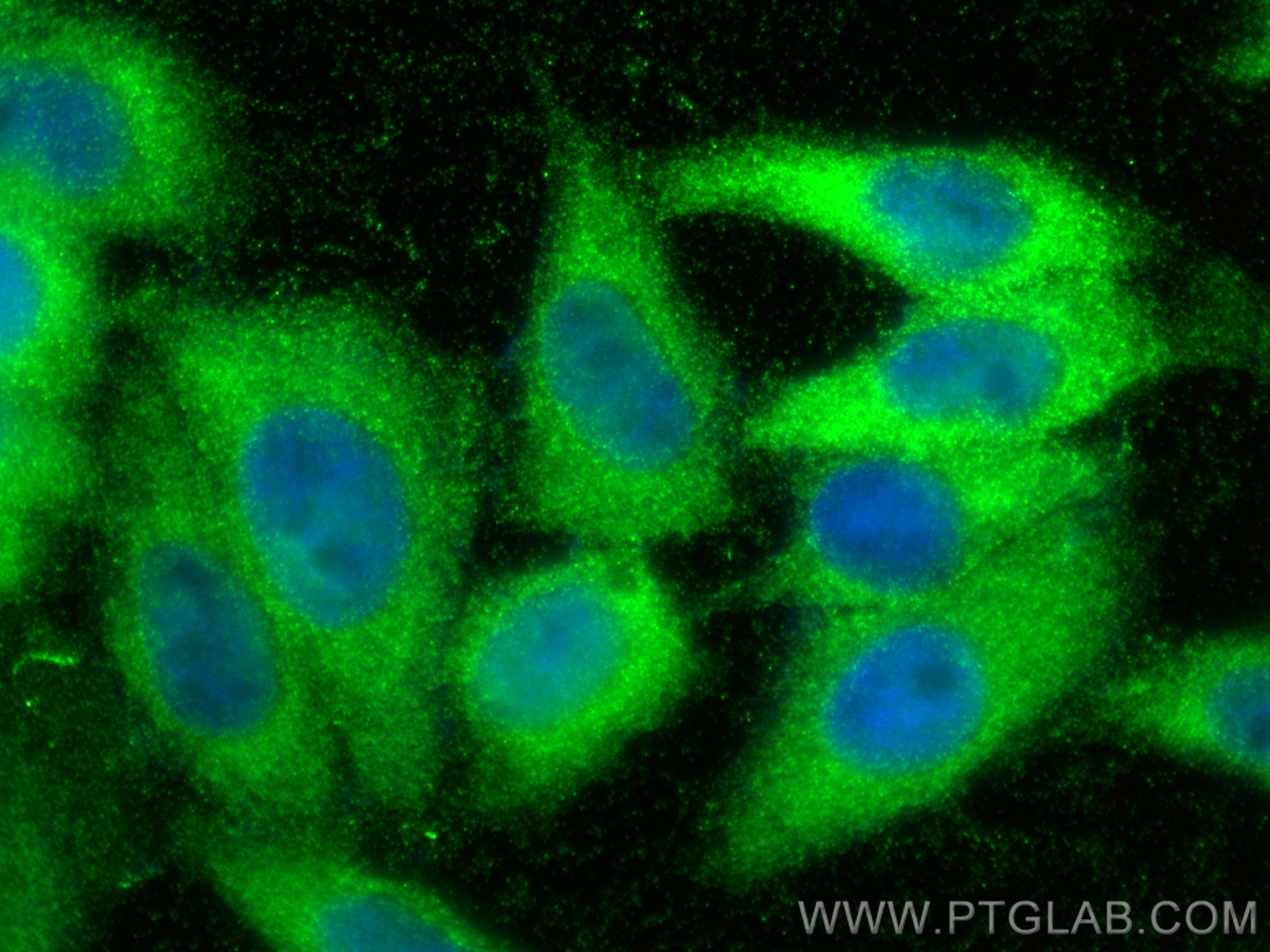 Immunofluorescence (IF) / fluorescent staining of HepG2 cells using NAMPT/PBEF Monoclonal antibody (66385-1-Ig)