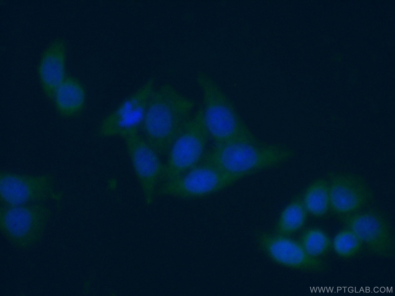Immunofluorescence (IF) / fluorescent staining of HeLa cells using NAMPT/PBEF Monoclonal antibody (66385-1-Ig)
